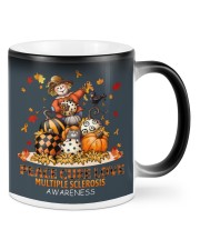 Multipl Sclerosi peace love cure fall lqt pml Mugs tile