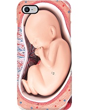 Neonatal fetus pc dvhh ntv Phone Case i-phone-8-case