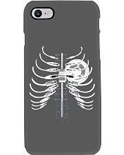 audiologist audio engineer bone lqt pml Phone Case tile