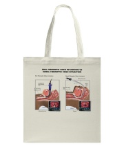 nasal-intubation-vs-endotracheal-lqt-pml Tote Bag tile