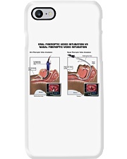 nasal-intubation-vs-endotracheal-lqt-pml Phone Case tile