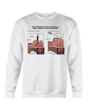 nasal-intubation-vs-endotracheal-lqt-pml Crewneck Sweatshirt tile