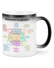 anatomy-quadrants-of-the-abdomen-lqt-pml Mugs tile