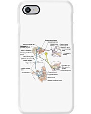 otology Facial nerve lqt lbs Phone Case tile