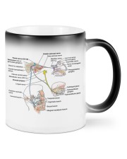 otology Facial nerve lqt lbs Mugs tile