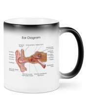 Ear-diagram-audiology-dvhh pml Mugs tile
