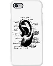 Otolaryngologist-ear-anatomy-lqt-nna Phone Case tile