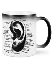 Otolaryngologist-ear-anatomy-lqt-nna Mugs tile