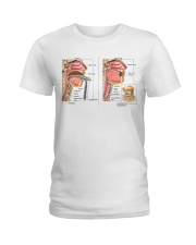 endotracheal-tube-vs-tracheal-tube-lqt-nna Ladies T-Shirt tile