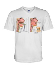 endotracheal-tube-vs-tracheal-tube-lqt-nna V-Neck T-Shirt tile