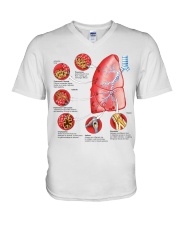 pulmonology disease of the lungs lqt pml V-Neck T-Shirt tile
