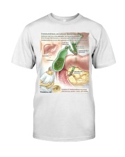 gastroenterology choledocholithiasis jama lqt lbs Premium Fit Mens Tee tile