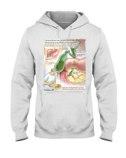 gastroenterology choledocholithiasis jama lqt lbs Hooded Sweatshirt tile