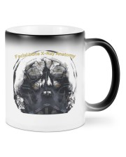 radiology facial bone x ray lqt pml Mugs tile