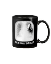 The X-ray Of The Heart Mug tile