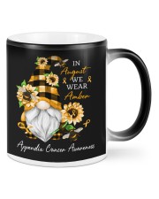 Appendix Cancer Mugs tile