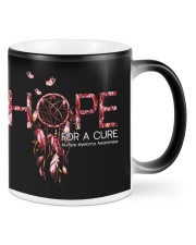 Multiple Myeloma Mugs tile