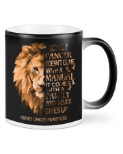 Kidney cancer Mugs tile