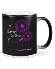 Pancreatic Cancer Mugs tile