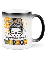 Appendix Cancer Mugs tile