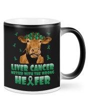 Liver Cancer Mugs tile