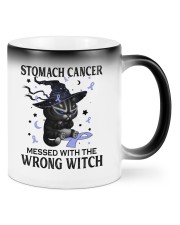 Stomach Cancer Mugs tile