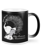 Skin Cancer Mugs tile