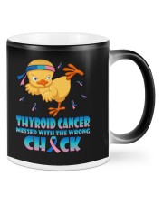 Thyroid Cancer Mugs tile