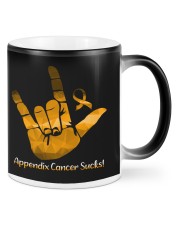 Appendix Cancer Mugs tile