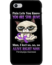 Pain lets you know Phone Case tile