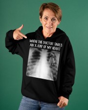 When Doctor Takes X-ray Of My Heart Black Mouth Cur Hooded Sweatshirt apparel-hooded-sweatshirt-lifestyle-front-88