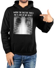 When Doctor Takes X-ray Of My Heart Black Mouth Cur Hooded Sweatshirt custom-hoodie-sweatshirt-lifestyle-front-188