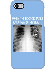 When Doctor Takes X-ray Of My Heart Italian Greyhound Phone Case tile