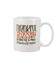 Mammographer Mug tile