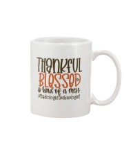 Radiologic Technologist Mug tile