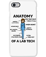 Lab Tech - Laboratory Technician Phone Case tile