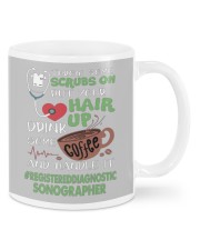 Registered Diagnostic Sonographer Mugs tile