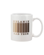 Rad Tech - Radiologic Technologist Mug tile