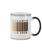 Rad Tech - Radiologic Technologist Color Changing Mug tile