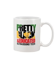 Ultrasound Tech Mug tile
