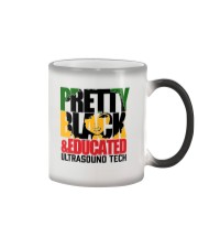 Ultrasound Tech Color Changing Mug tile