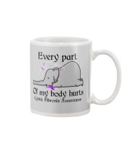 Every part of my body hurts Mug tile