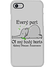 Every part of my body hurts Phone Case tile