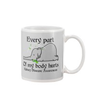 Every part of my body hurts Mug tile