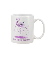 Limited Edition Mug tile