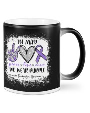 In May We Wear Purple For Fibromyalgia Awareness Mugs tile