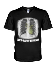 The X-ray Of My Heart V-Neck T-Shirt tile