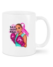 Bald Chicks Rule Mugs tile