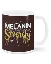 Melanin Poppin' Severely Mugs tile