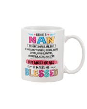 1 DAY LEFT - GET YOURS NOW Mug tile